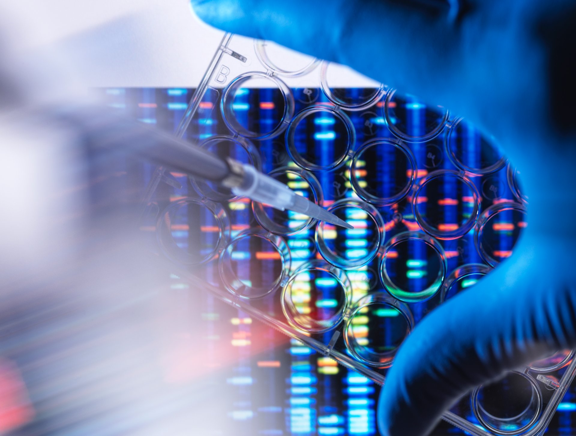 Close-up of scientist pipetting sample in multi well plate for DNA analysis with genetic results in background.