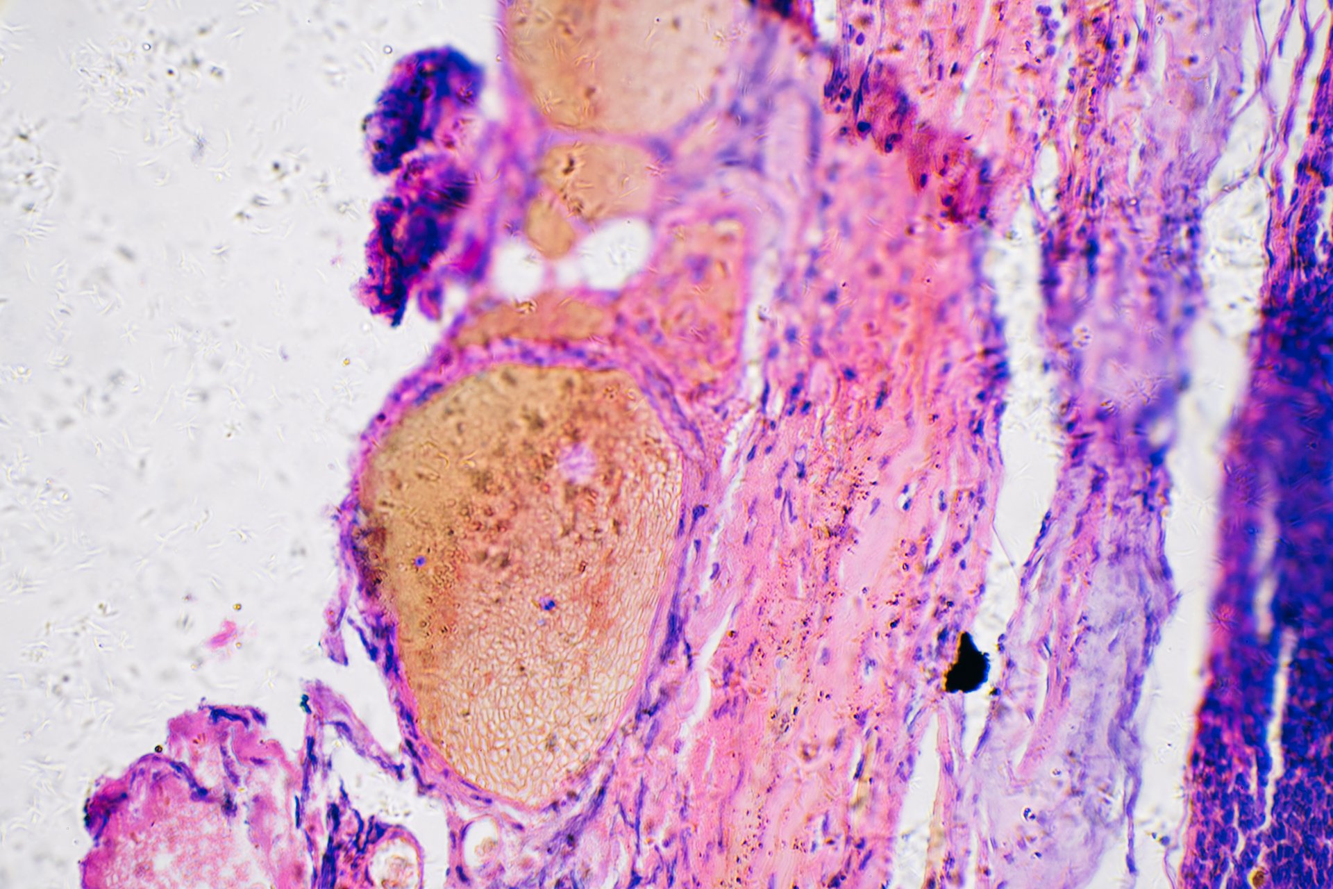 Photograph of a microscopic view of tissue stained with purple and pink dyes, highlighting cellular structures and layers.